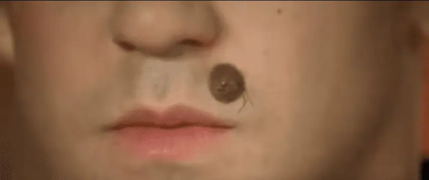 Austin Powers mole